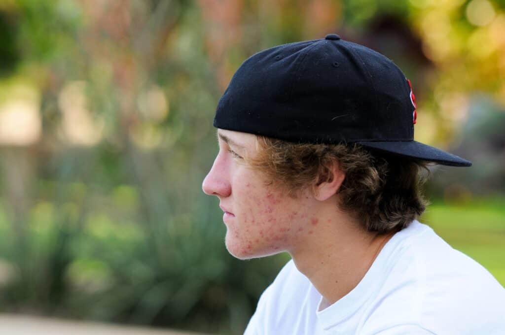 signs of trauma in adolescence