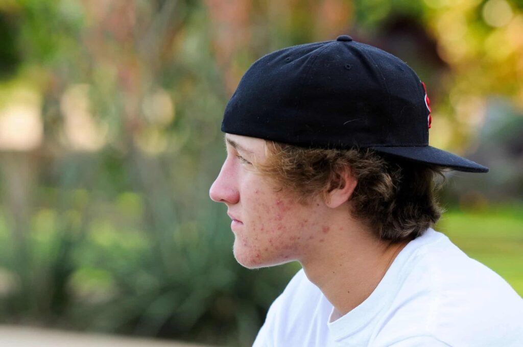 signs of trauma in adolescence