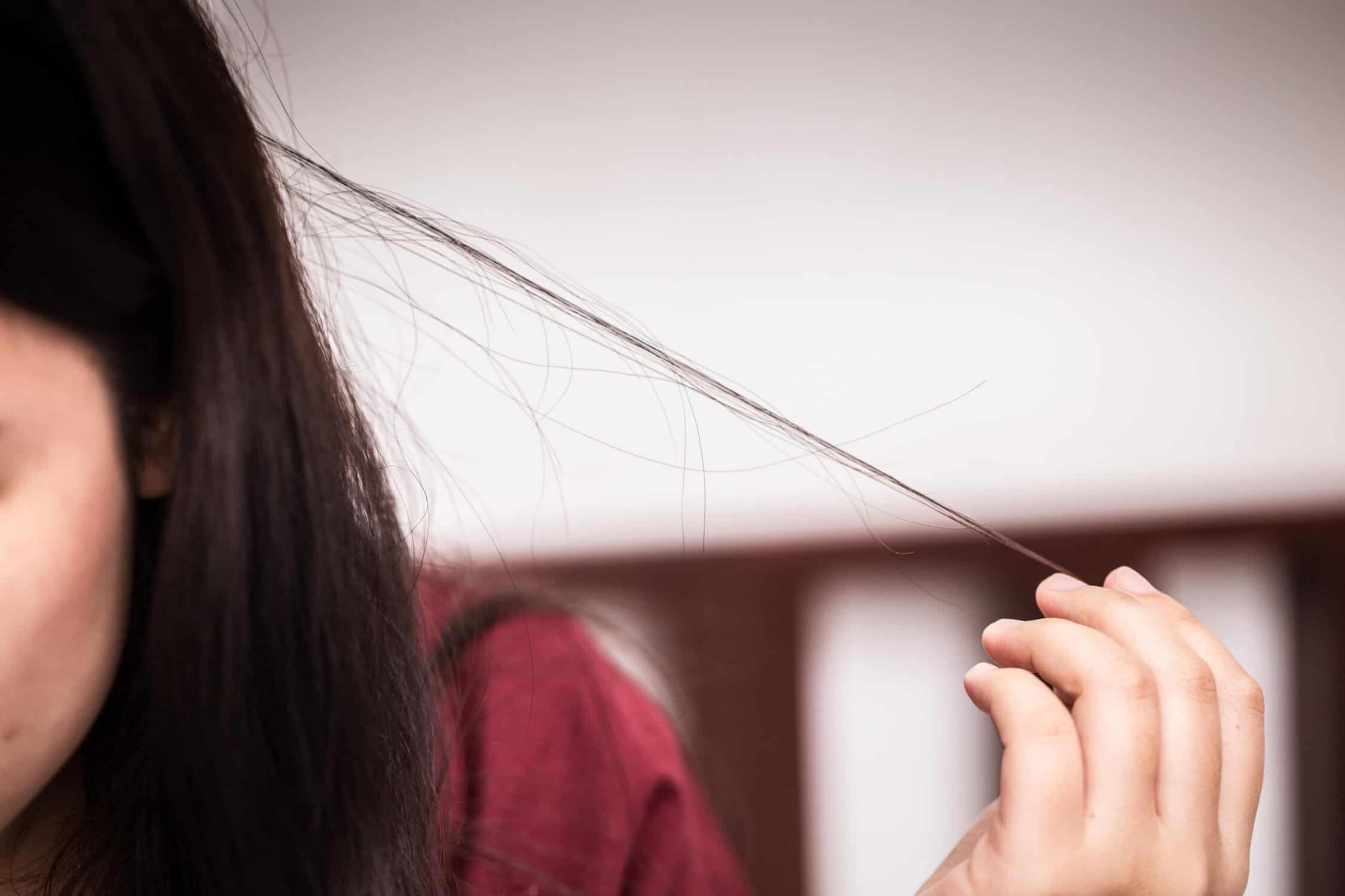 trichotillomania